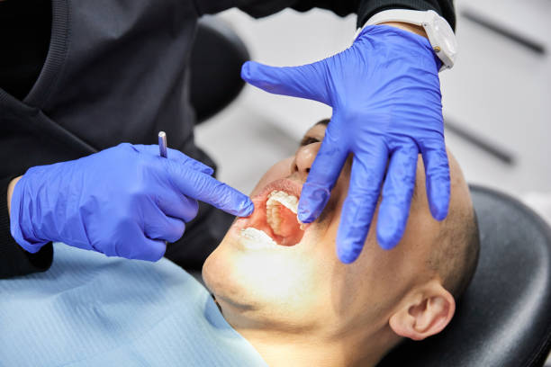 Best Knocked-Out Tooth (Avulsed Tooth) Treatment in Jemison, AL