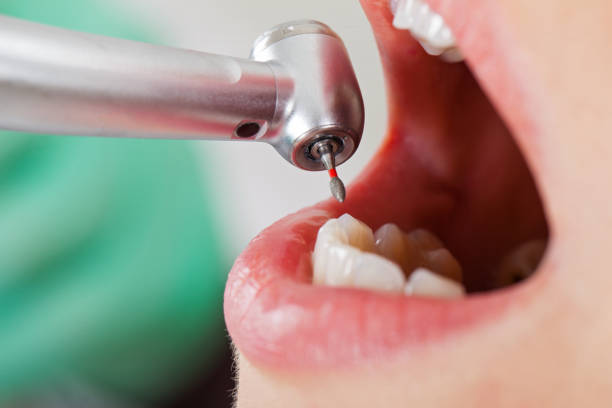 Best Emergency Care for Gum Disease in Jemison, AL